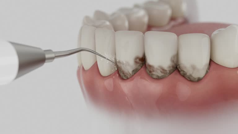 Reliable Dental Implants contractor in Elsmere, DE by Smile Center Dentistry